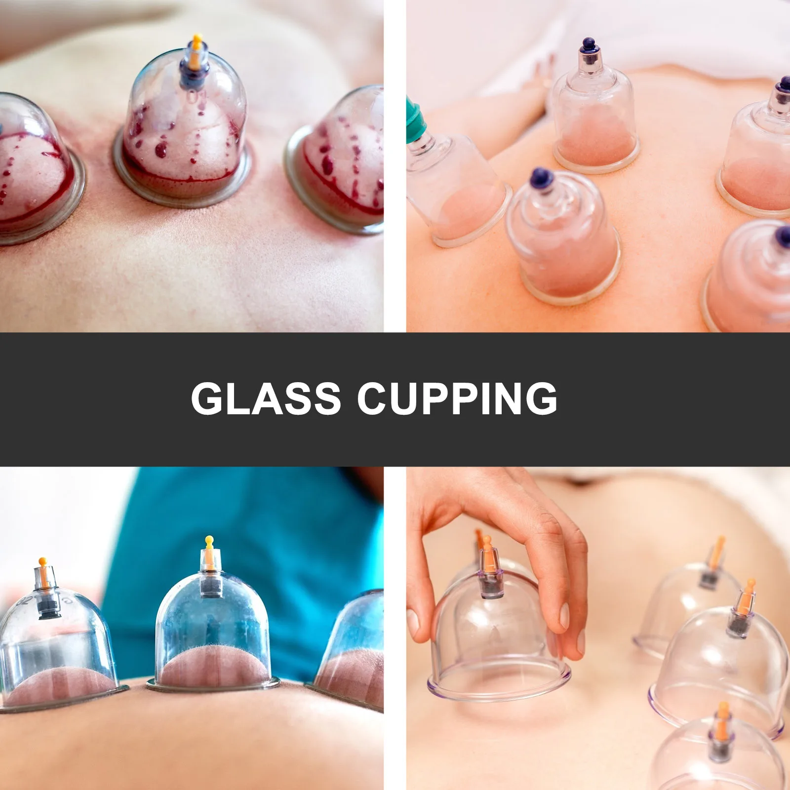 1 Set Therapy Device Large Body Massage Vacuum Tool For Back Neck Shoulder Pain Relief Negative Pressure Cupping Body Cupping
1 Set Therapy Device Large Body Massage Vacuum Tool For Back Neck Shoulder Pain Relief Negative Pressure Cupping Body Cupping