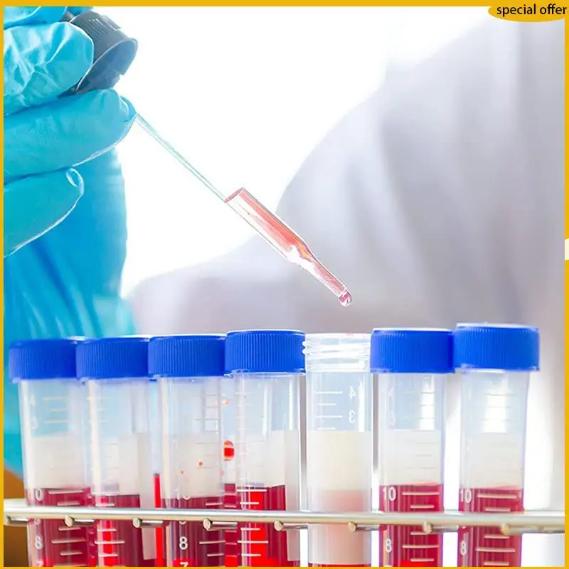 A50I Conical Centrifuge Tubes 15ML, 400 Pcs Sterile Plastic Test Tubes With Screw Caps, Polypropylene Container
A50I Conical Centrifuge Tubes 15ML, 400 Pcs Sterile Plastic Test Tubes With Screw Caps, Polypropylene Container