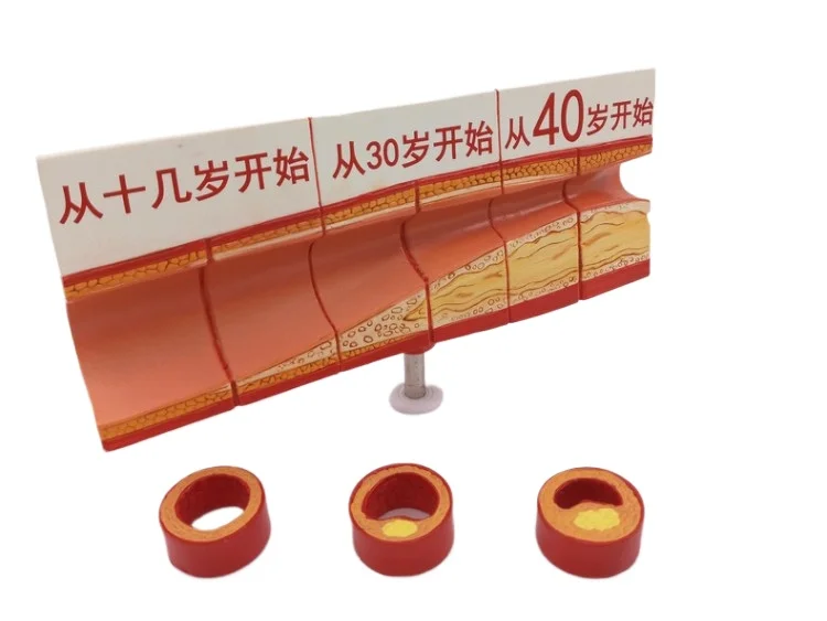 Cardiovascular Artery Anatomy Model, Thrombosis Model, Human Vascular Model
Cardiovascular Artery Anatomy Model, Thrombosis Model, Human Vascular Model