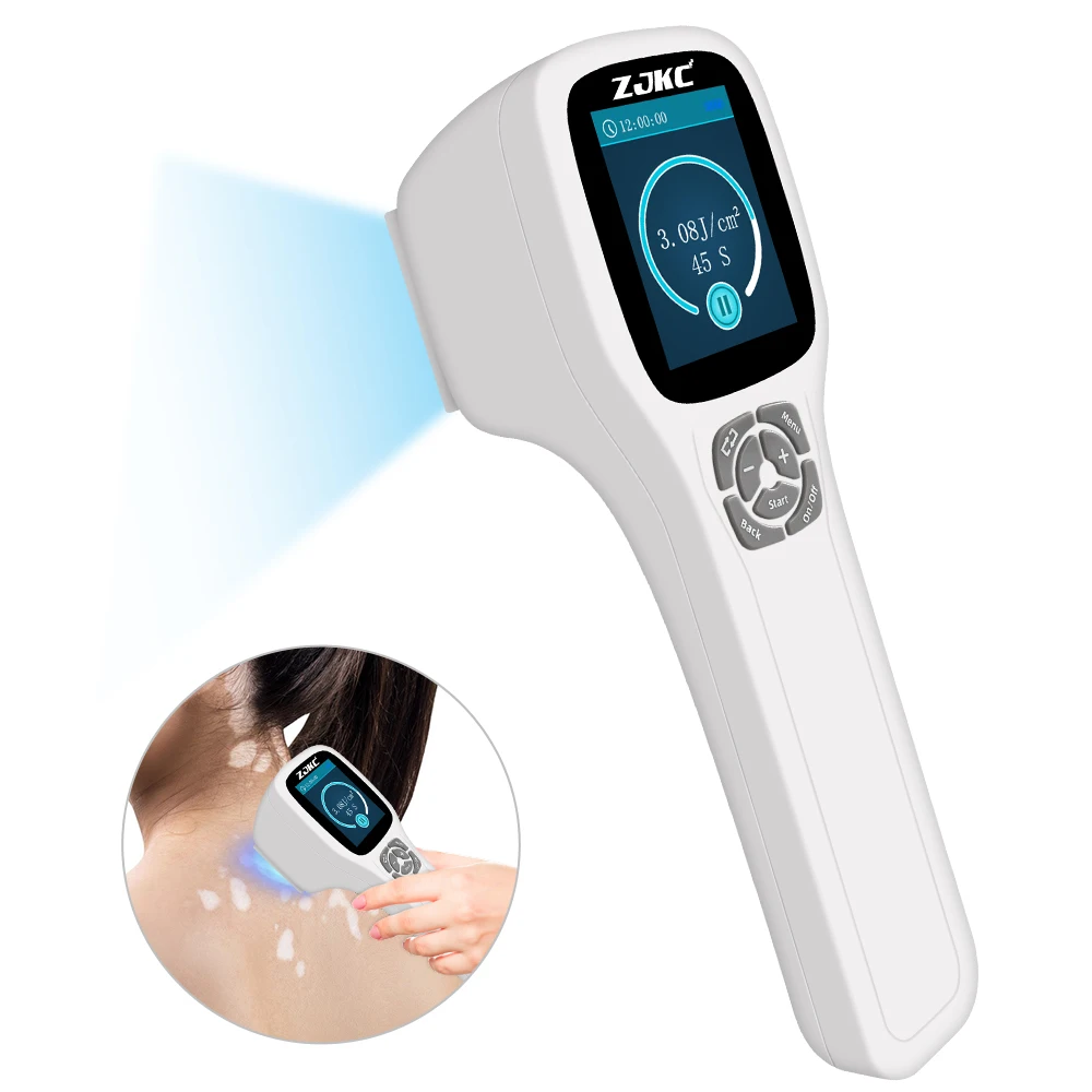 Frovab LED 308nm Lamp Phototherapy Vitiligo UVB Treatment Portable 308nm Excimer Household UVB Phototherapy Device for Eczema
Frovab LED 308nm Lamp Phototherapy Vitiligo UVB Treatment Portable 308nm Excimer Household UVB Phototherapy Device for Eczema