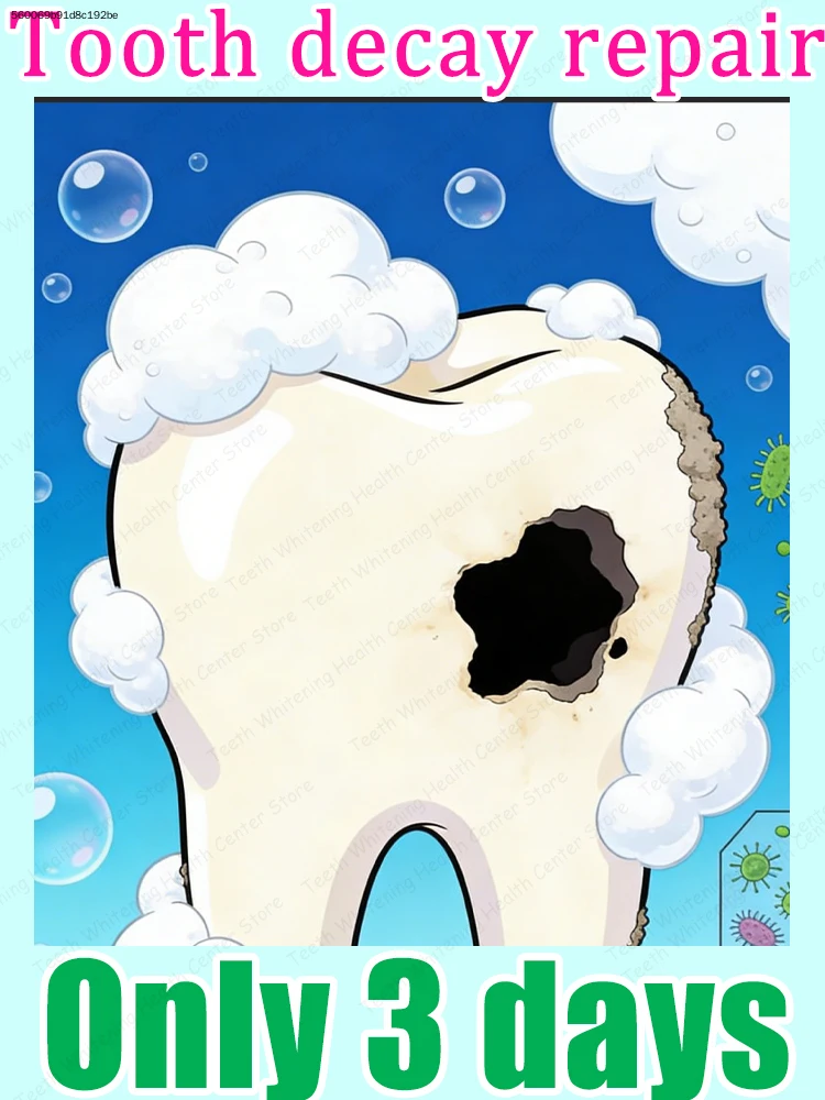 Don’t let cavities become a big problem,ʳᵉᵖᵃⁱʳ ᶜᵃᵛⁱᵗⁱᵉˢ ⁱⁿ ³ ᵈᵃʸˢ
Don’t let cavities become a big problem,ʳᵉᵖᵃⁱʳ ᶜᵃᵛⁱᵗⁱᵉˢ ⁱⁿ ³ ᵈᵃʸˢ