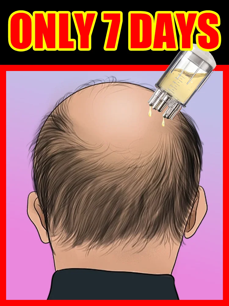 Generation-2,Scalp Applicator Liquid Comb Portable Mini Massage Comb Liquid Guiding Massager Anti Hair Loss Scalp Care Tool 7day
Generation-2,Scalp Applicator Liquid Comb Portable Mini Massage Comb Liquid Guiding Massager Anti Hair Loss Scalp Care Tool 7day