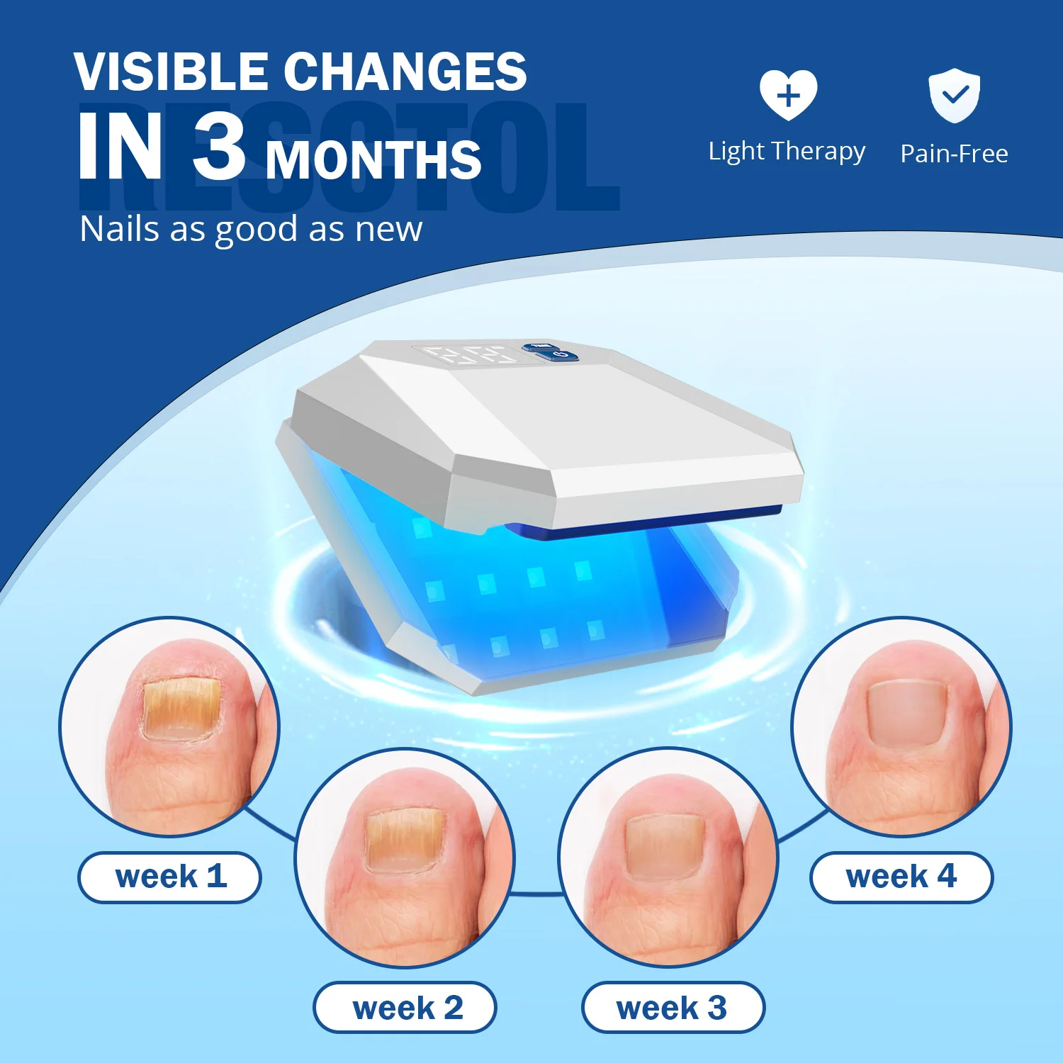 Wireless Nail Fungus Laser Device One Size Fits All 2000mAh LED 470nm 905nm Nail Laser Treatment Device for Onychomycosis
Wireless Nail Fungus Laser Device One Size Fits All 2000mAh LED 470nm 905nm Nail Laser Treatment Device for Onychomycosis