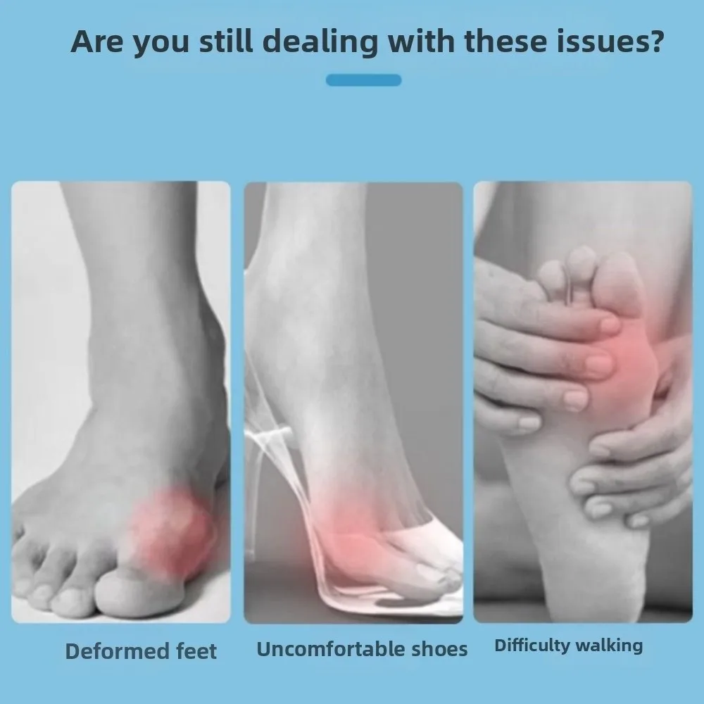 1 Pair Adjustable Bunion Corrector Toe Valgus Joint Support Big Toe Straightener Bunion Splint Dislocation Fracture
1 Pair Adjustable Bunion Corrector Toe Valgus Joint Support Big Toe Straightener Bunion Splint Dislocation Fracture