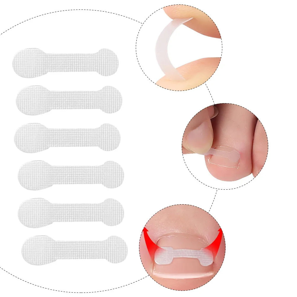 30pcs Toenail Corrector Stickers Orthopedic Foot Care For Bunion Pain Relief Hallux Valgus Support Patch Strip
30pcs Toenail Corrector Stickers Orthopedic Foot Care For Bunion Pain Relief Hallux Valgus Support Patch Strip
