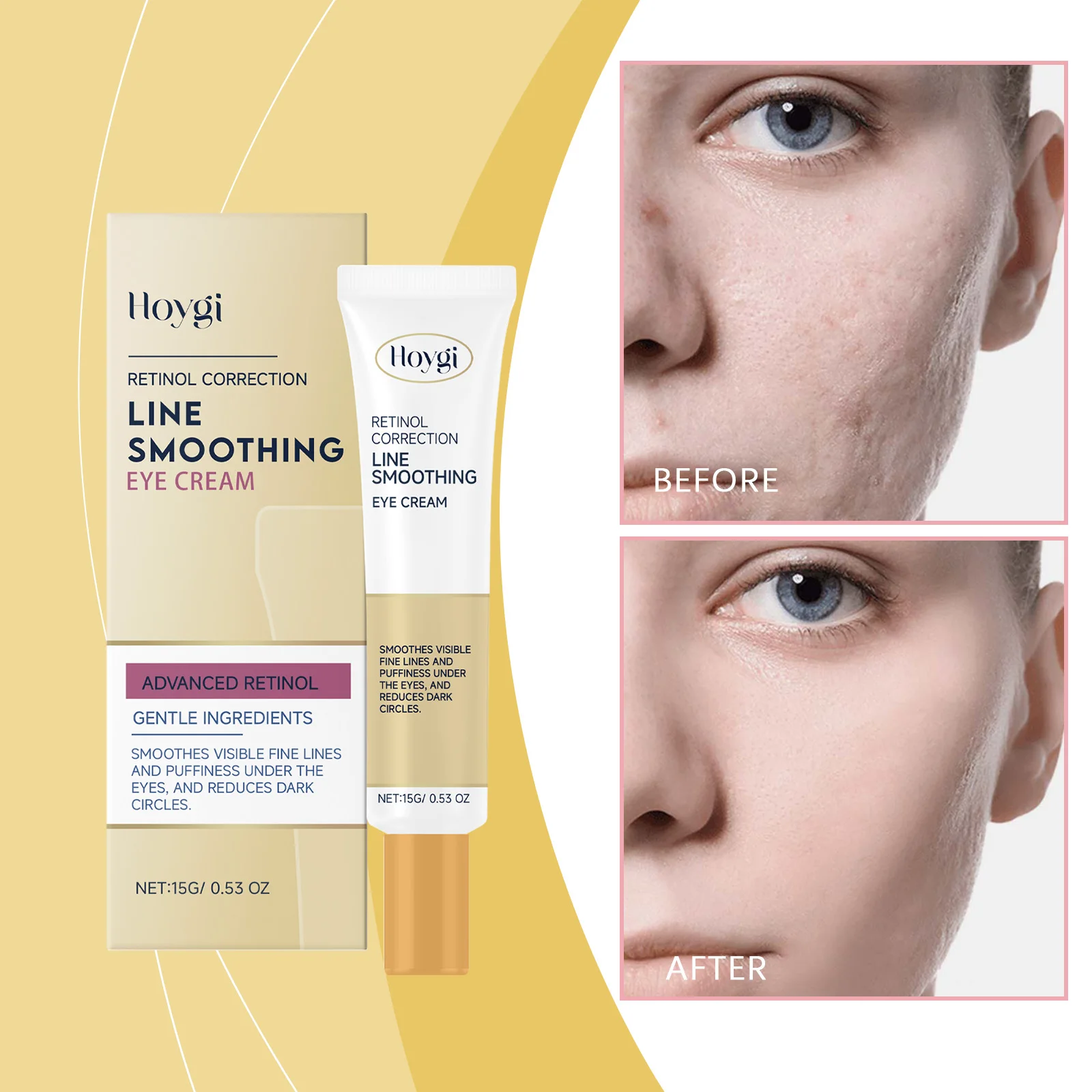 Retinol Wrinkle Cream Anti-wrinkle Remove Dark Circles Anti-puffiness Lighten Dark Spots Moisturize And Brighten Eye Care
Retinol Wrinkle Cream Anti-wrinkle Remove Dark Circles Anti-puffiness Lighten Dark Spots Moisturize And Brighten Eye Care