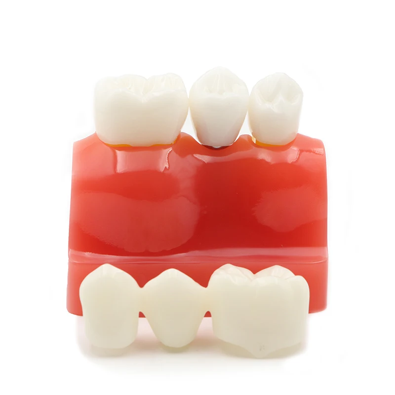 HST-M3 Implant Model Dental Teaching Model
HST-M3 Implant Model Dental Teaching Model