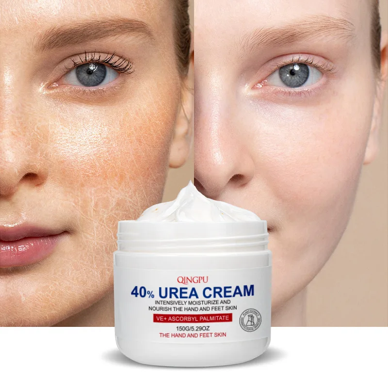 150g Face Body Whiten Repair Cream Keratosis Pilaris Treatment Bumpy Rough Chicken Follicle Skin Red Bloodshot Removal Dry Skin
150g Face Body Whiten Repair Cream Keratosis Pilaris Treatment Bumpy Rough Chicken Follicle Skin Red Bloodshot Removal Dry Skin