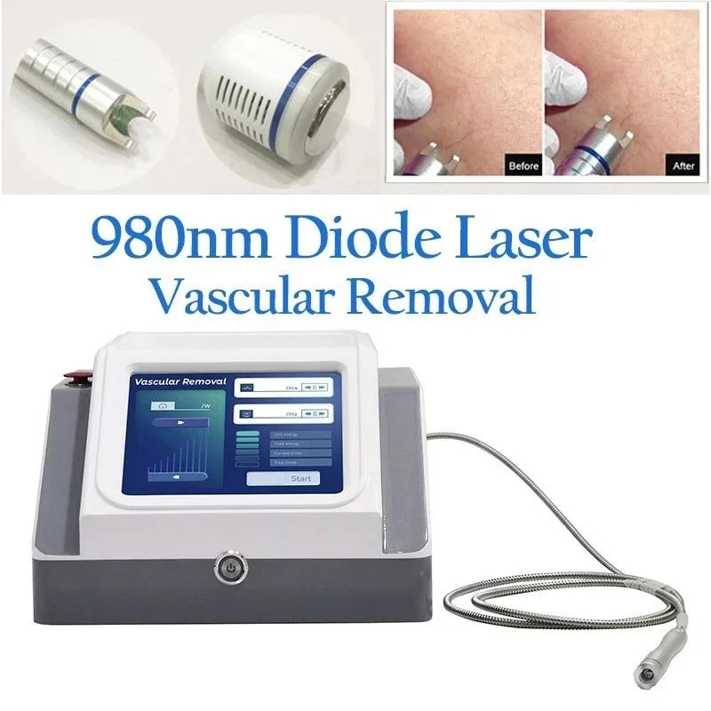 980nm Diode Laser Standing Vascular Removal Machine Temperature Control Cooling Fiber Handpiece Safe Red Blood Streak Removal
980nm Diode Laser Standing Vascular Removal Machine Temperature Control Cooling Fiber Handpiece Safe Red Blood Streak Removal