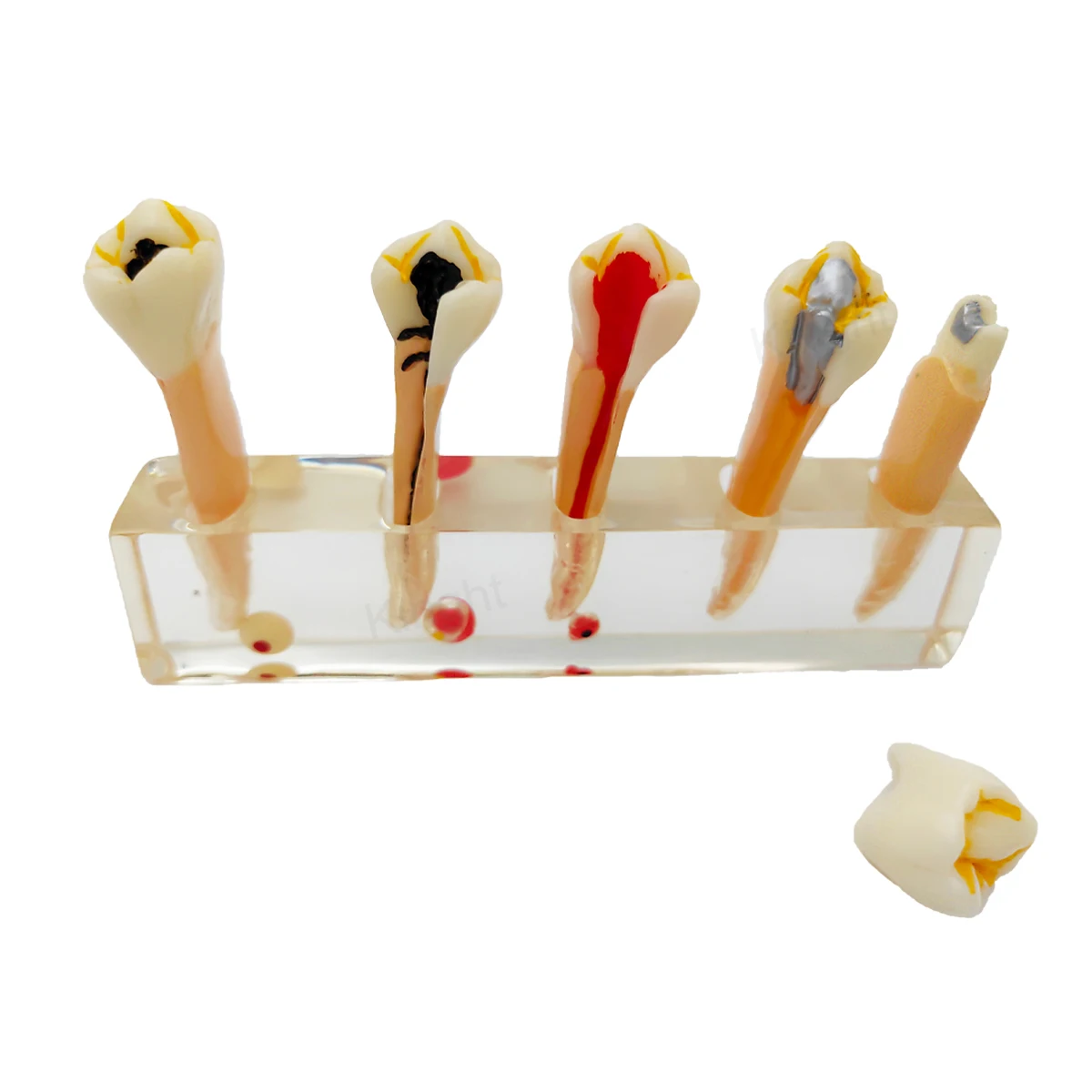 Dental Endodontic Teeth Model Demonstrates 5 Stages of Root Canalprocedure for Dentist Student Pathological Training Tools
Dental Endodontic Teeth Model Demonstrates 5 Stages of Root Canalprocedure for Dentist Student Pathological Training Tools