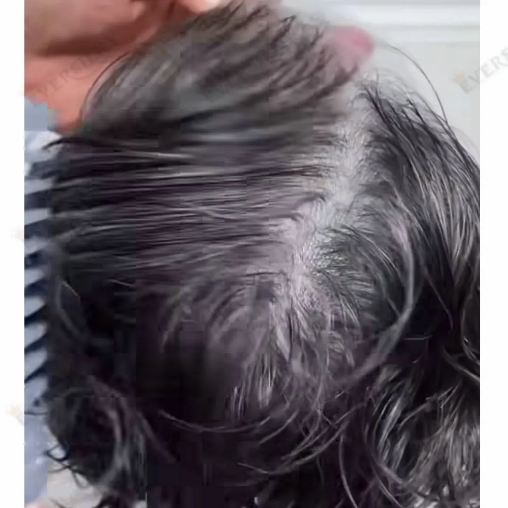 Undetectable 80Density Super Thin Skin 0.02mm Men's Toupee 1b80 520#Grey Brown Real Human Hair Male Capillary Prosthesis System
Undetectable 80Density Super Thin Skin 0.02mm Men's Toupee 1b80 520#Grey Brown Real Human Hair Male Capillary Prosthesis System