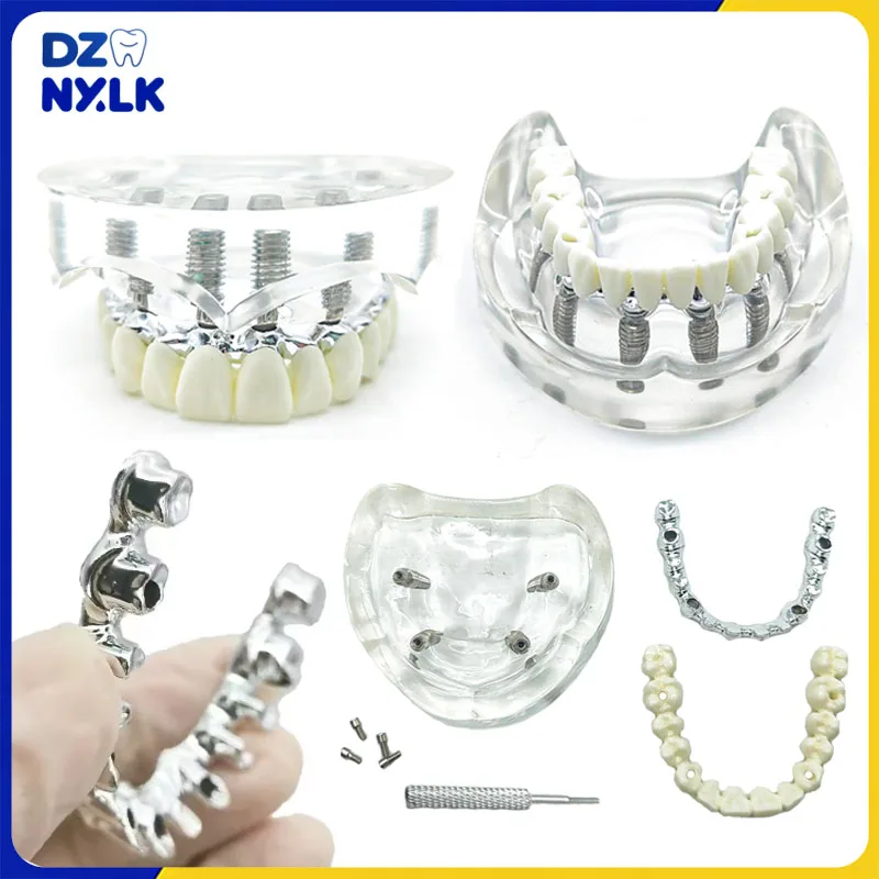 Стоматологическая модель, модель для восстановления имплантата, съемная модель для зубного протеза с 4/6 имплантатами, модель для обучения студентов-стоматологом
Стоматологическая модель, модель для восстановления имплантата, съемная модель для зубного протеза с 4/6 имплантатами, модель для обучения студентов-стоматологом