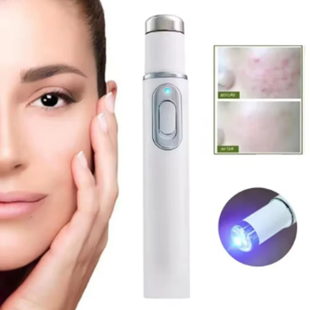 Blue Light Facial Beauty Device Eye Massager for Black Eye Circles Texture Maintenance And Eye Bag Reduction - Facial Care Tool
Blue Light Facial Beauty Device Eye Massager for Black Eye Circles Texture Maintenance And Eye Bag Reduction - Facial Care Tool
