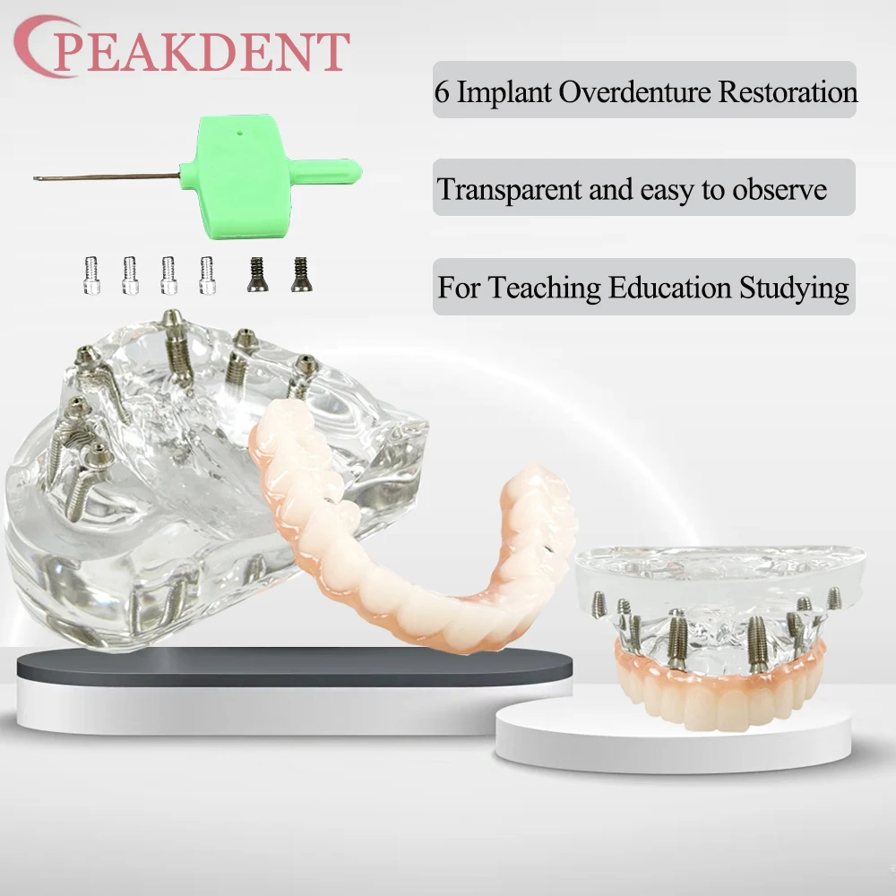 Dental Implant Teeth Model Transparent Upper Jaw Type Overdenture Modle With 6 Removable Screws for Researching Medical
Dental Implant Teeth Model Transparent Upper Jaw Type Overdenture Modle With 6 Removable Screws for Researching Medical