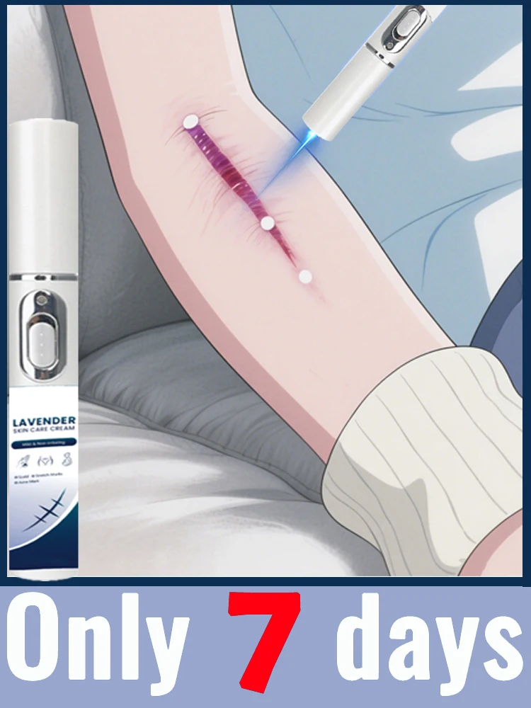 Лазерная ручка для беременных с растяжкой: подходит для новых и ожидающих мам (породовое использование) 
Лазерная ручка для беременных с растяжкой: подходит для новых и ожидающих мам (породовое использование)