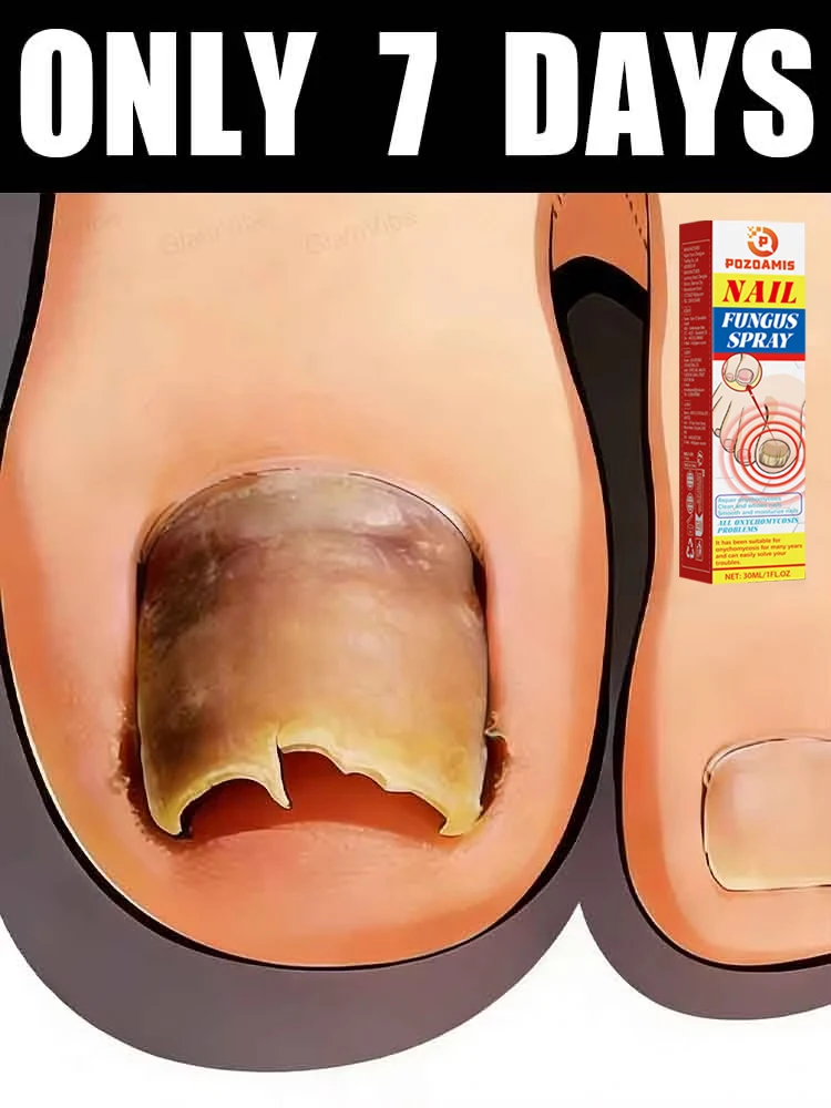 ᴺᵃᵗᵘʳᵃˡ ʳᵉᵖᵃⁱʳ⸴ ʳᵉˢᵗᵒʳᵉ ʰᵉᵃˡᵗʰʸ ⁿᵃⁱˡˢ⸴Don't hesitate, take action now!
ᴺᵃᵗᵘʳᵃˡ ʳᵉᵖᵃⁱʳ⸴ ʳᵉˢᵗᵒʳᵉ ʰᵉᵃˡᵗʰʸ ⁿᵃⁱˡˢ⸴Don't hesitate, take action now!