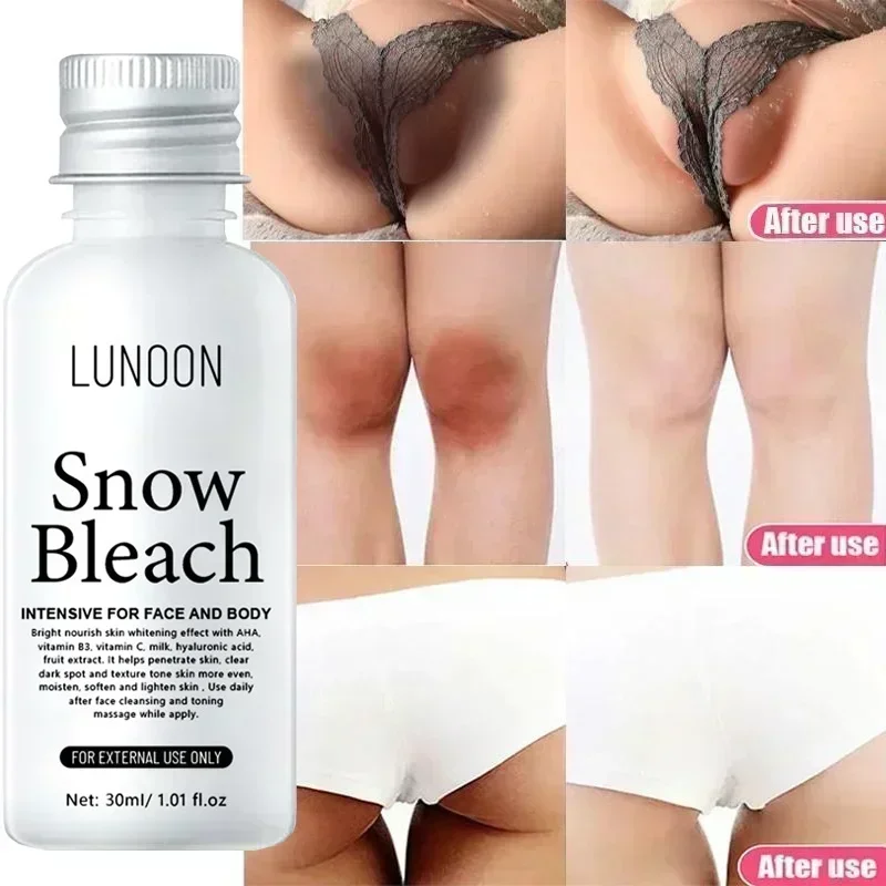 Whitening Cream Private Parts Underarm Bleaching Serum Whiten Butt Knee Brighten Inner Thigh Intimate Parts Dark Remove Melanin
Whitening Cream Private Parts Underarm Bleaching Serum Whiten Butt Knee Brighten Inner Thigh Intimate Parts Dark Remove Melanin