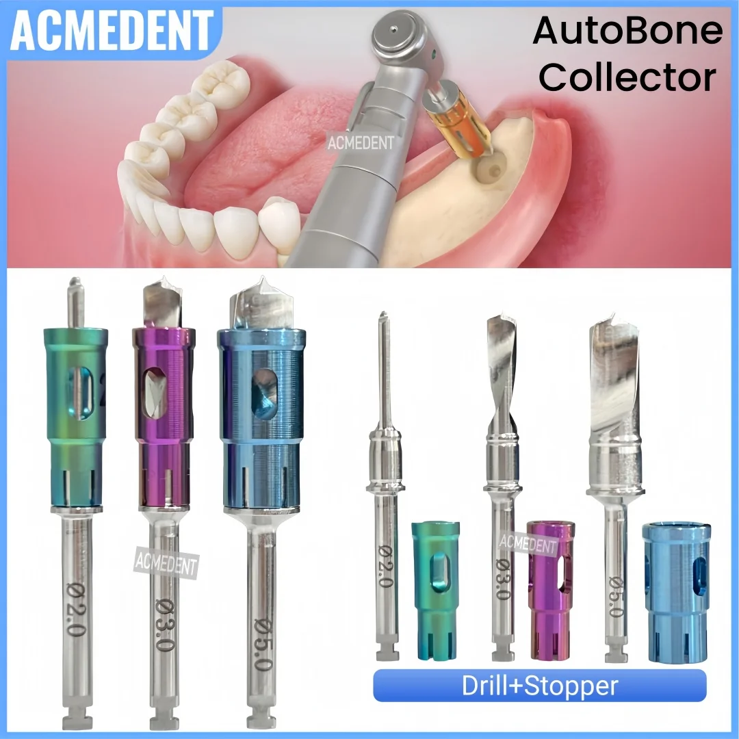 Dental GBR AutoBone Collector Drill With Stopper Bone Chip Marker Harvest Drill Implant Never Loss Self Bone Powder Gain 3Sizes
Dental GBR AutoBone Collector Drill With Stopper Bone Chip Marker Harvest Drill Implant Never Loss Self Bone Powder Gain 3Sizes