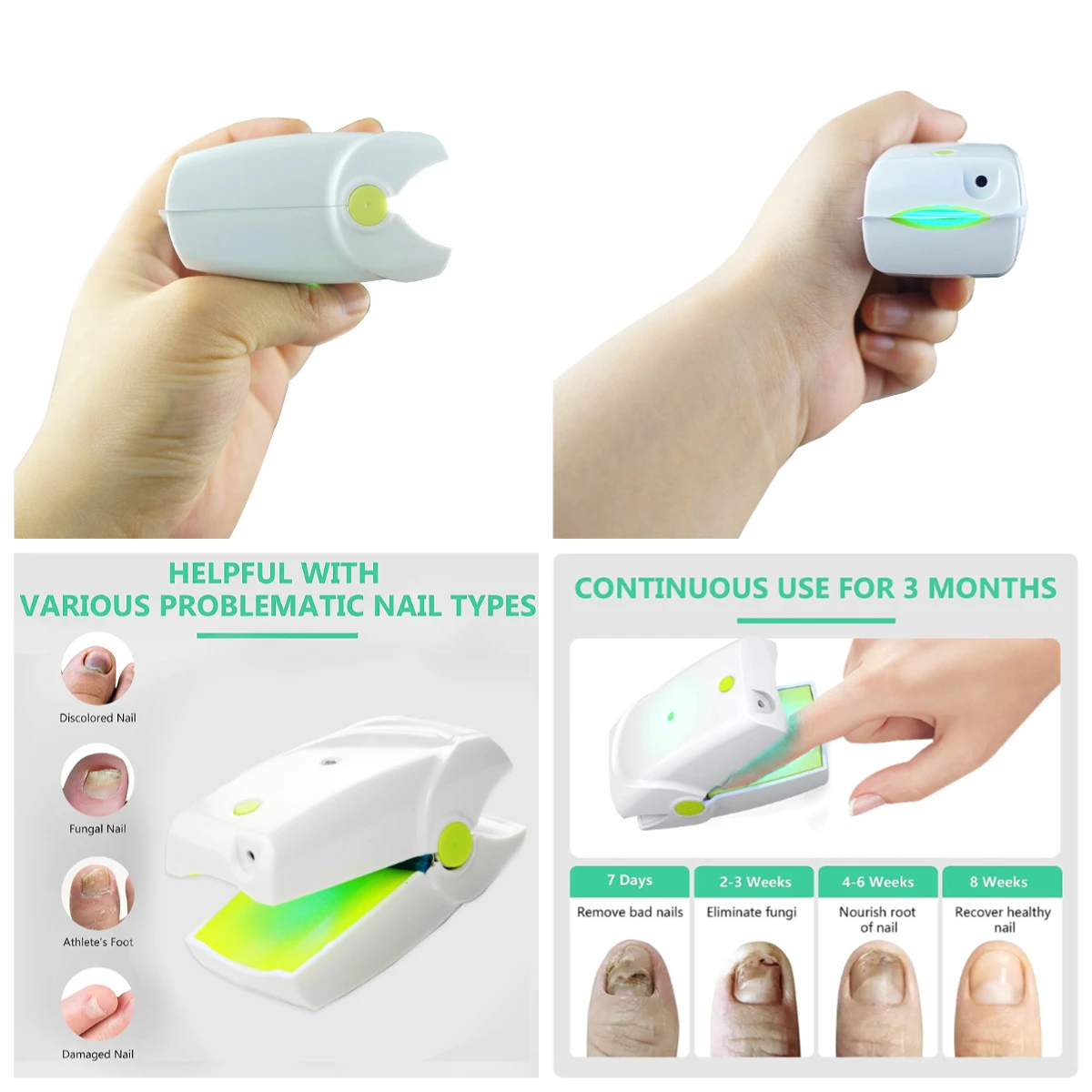 Профессиональное лазерное устройство для удаления грибка на ногах, ухода за ногтями, безопасное для домашнего использования
Профессиональное лазерное устройство для удаления грибка на ногах, ухода за ногтями, безопасное для домашнего использования