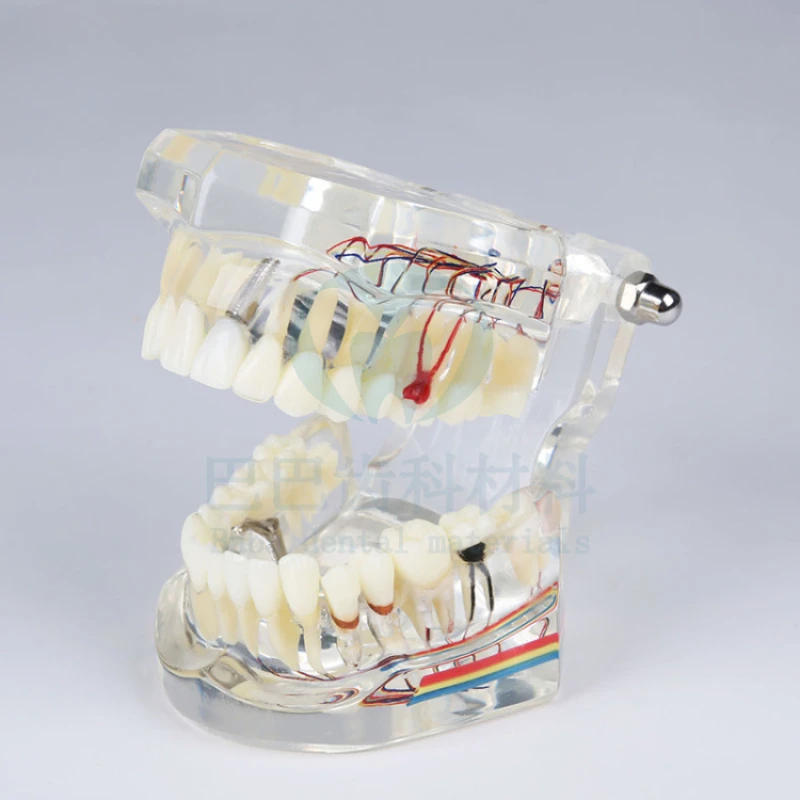 Dental Dental Teaching Removable Implant Repair Model Activity Dental Implant Dentist Patient Communication Package
Dental Dental Teaching Removable Implant Repair Model Activity Dental Implant Dentist Patient Communication Package