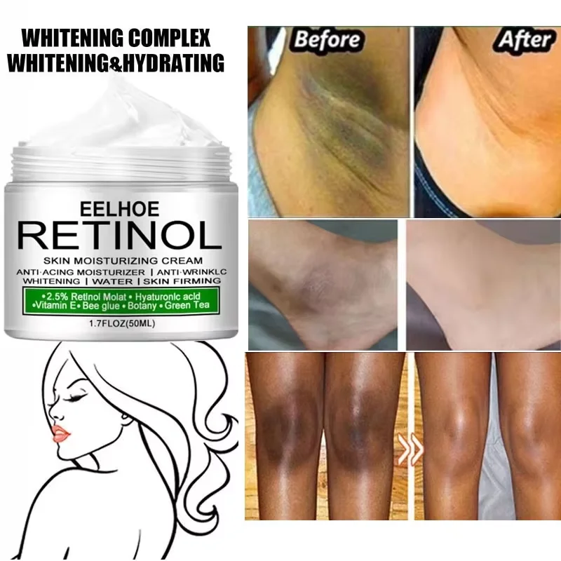 Body Whitening lightening Cream Underarm Bag Knee Buttocks Dark Skin Bleach lotion Improve Melanin Pigmentation Dull For Women
Body Whitening lightening Cream Underarm Bag Knee Buttocks Dark Skin Bleach lotion Improve Melanin Pigmentation Dull For Women