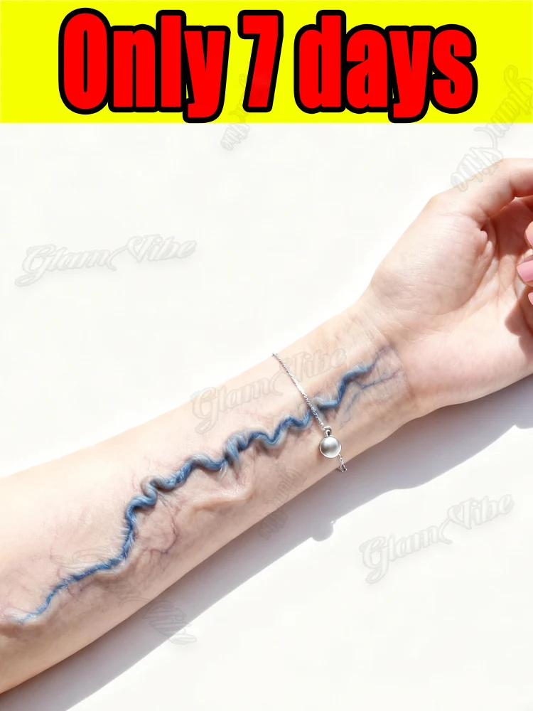 Второе поколение лазерной ручки для лечения варикозного расширения вен.
Второе поколение лазерной ручки для лечения варикозного расширения вен.