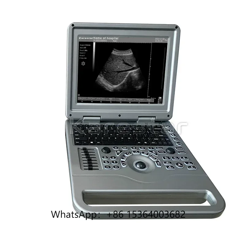 Hot Sale Vet Ultrasound Machine Cheap Price Ecografo for Animal Portable Ultrasound Scanner
Hot Sale Vet Ultrasound Machine Cheap Price Ecografo for Animal Portable Ultrasound Scanner