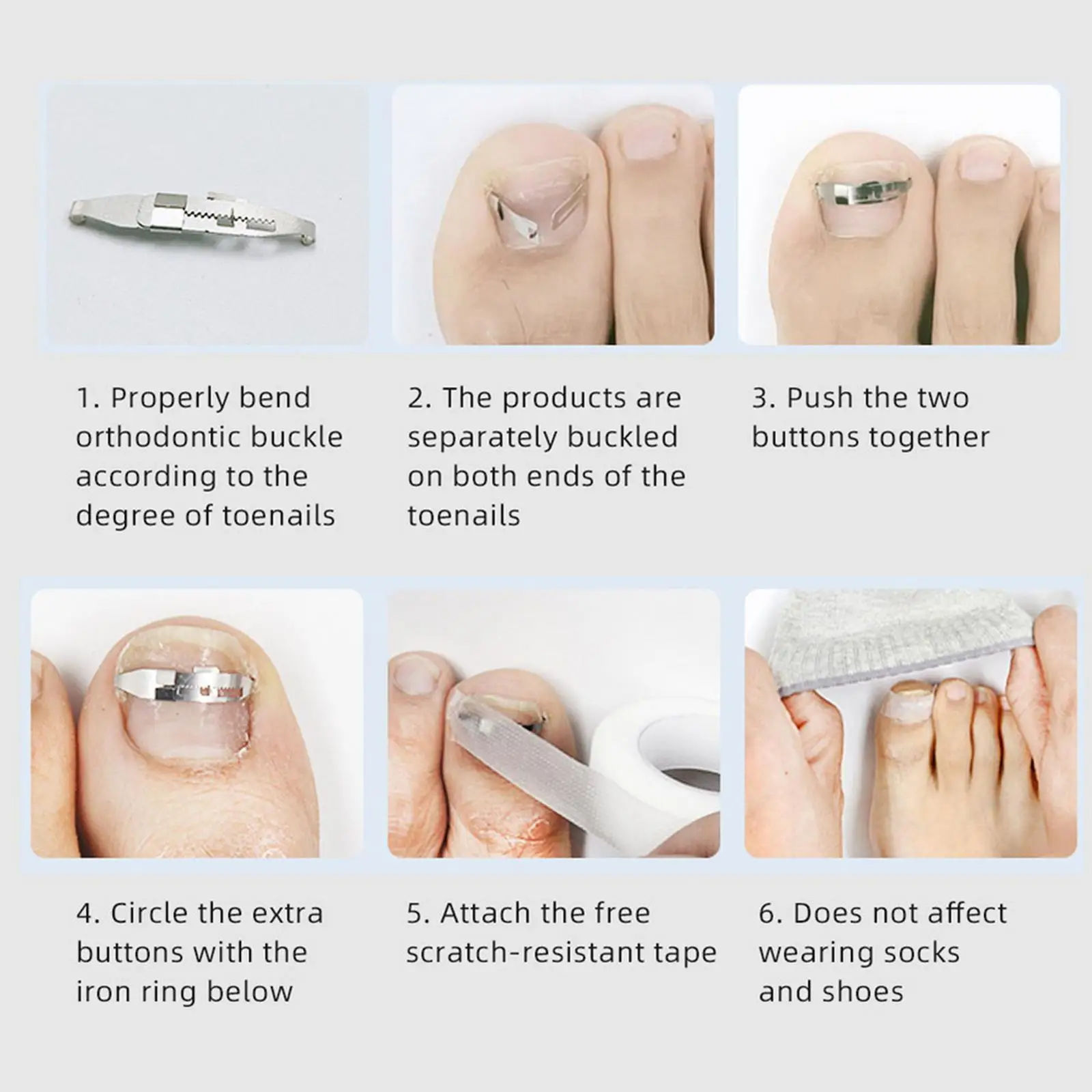 Professional Ingrown Nail Tool Kit Adjustable Nail Corrector Brace Lifter Pedicure Set for Home Foot Care
Professional Ingrown Nail Tool Kit Adjustable Nail Corrector Brace Lifter Pedicure Set for Home Foot Care