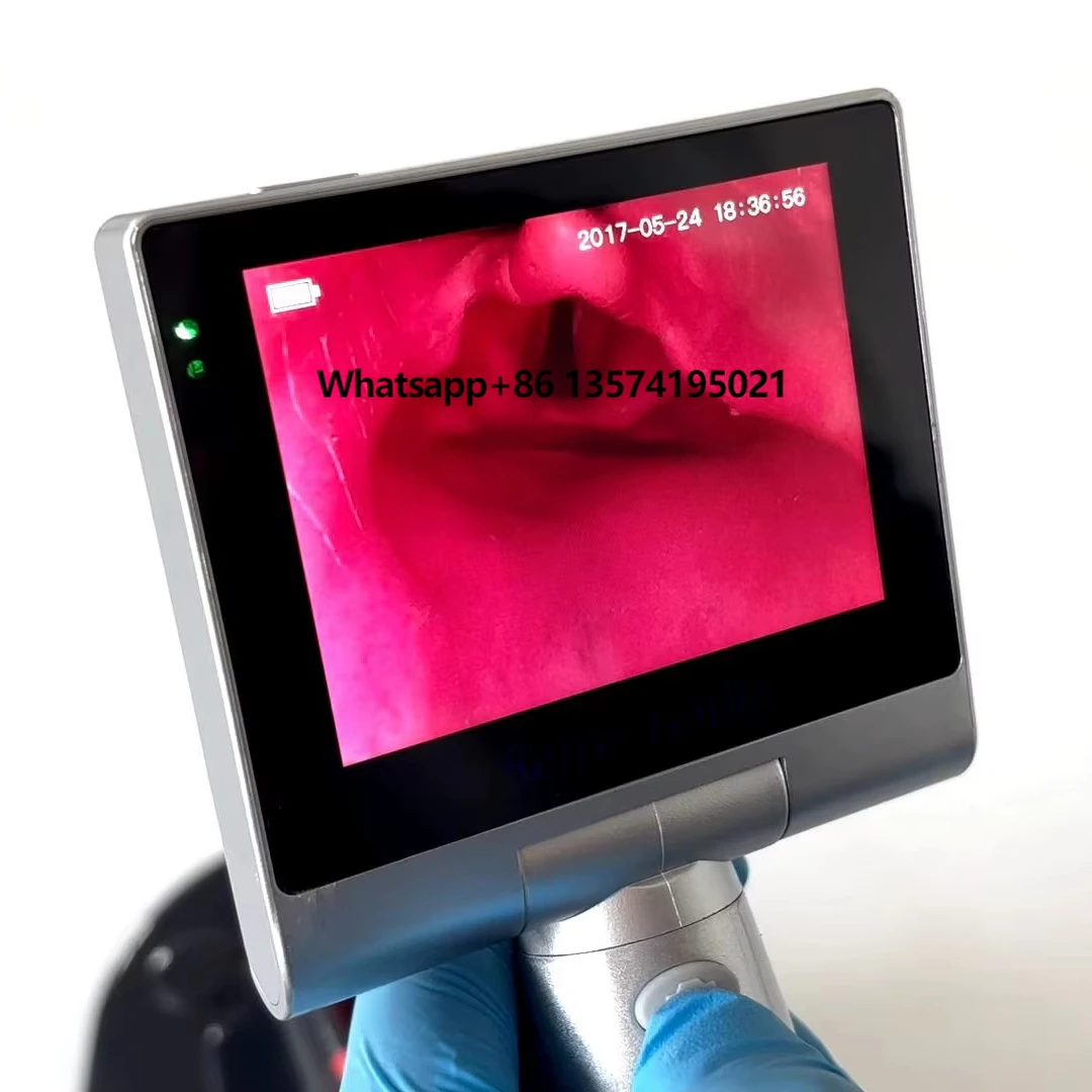 Sensorendo Rechargeable Intubating Disposable Laryngoscope Portable Anti Fog Water Proof Fiber Optic Videolaringoscope
Sensorendo Rechargeable Intubating Disposable Laryngoscope Portable Anti Fog Water Proof Fiber Optic Videolaringoscope
