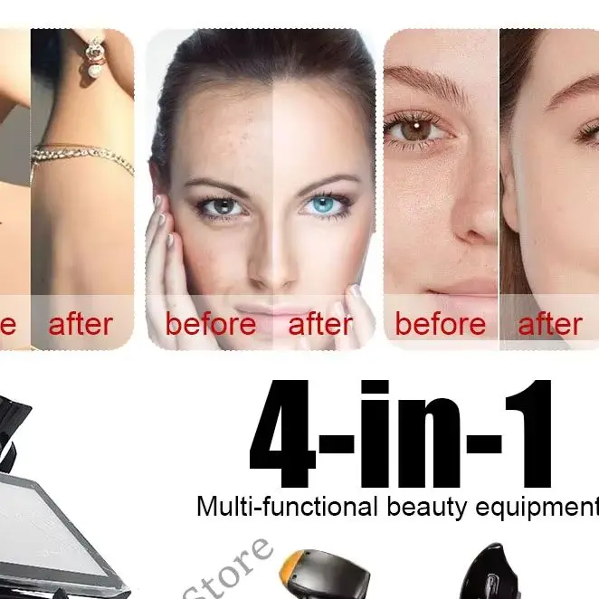 4 IN 1 Soprano Titanium Ice Platinum RF Diode 755 808 940 1064nm 4 Wave Laser ND:YAG Machine Painless Hair Removal Machine
4 IN 1 Soprano Titanium Ice Platinum RF Diode 755 808 940 1064nm 4 Wave Laser ND:YAG Machine Painless Hair Removal Machine