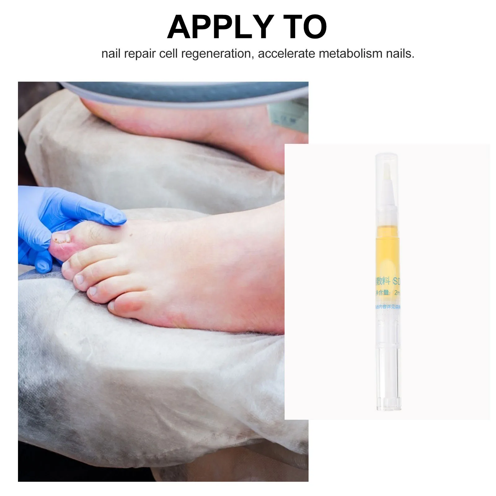 Антибактериальный гель для лечения ногтей, восстанавливающий и увлажняющий, для поврежденных, ломких и потрескавшихся ногтей, в форме ручки-аппликатора.
Антибактериальный гель для лечения ногтей, восстанавливающий и увлажняющий, для поврежденных, ломких и потрескавшихся ногтей, в форме ручки-аппликатора.