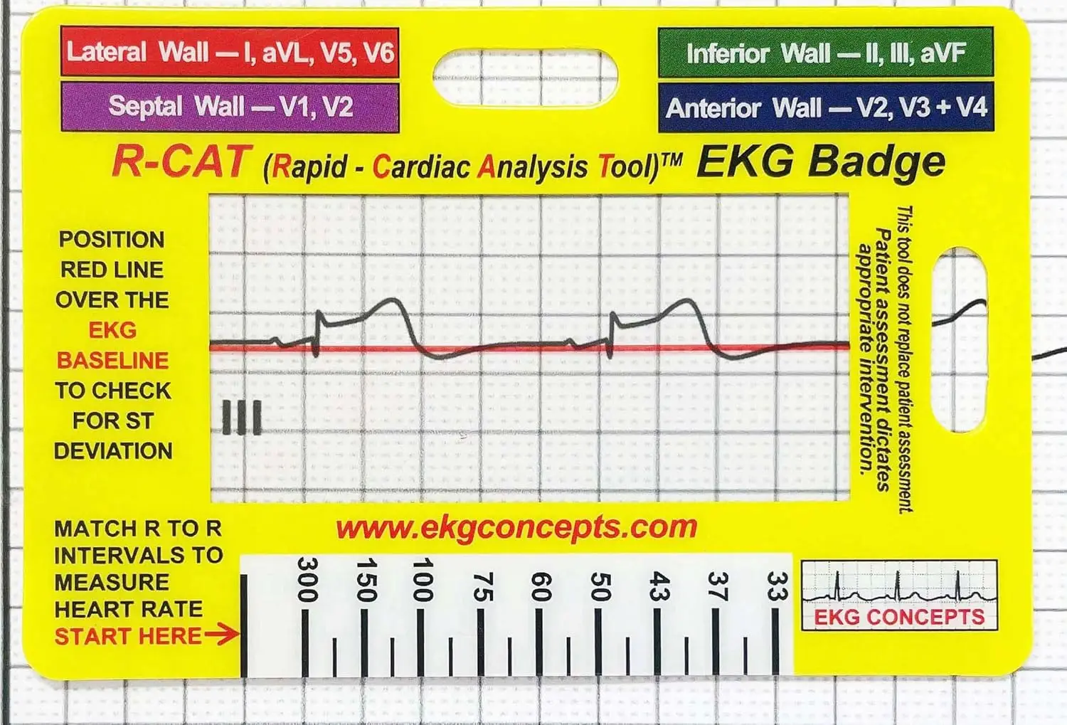 EKG Badge with See-Through Window for Quick Heart Rate Calculation
EKG Badge with See-Through Window for Quick Heart Rate Calculation