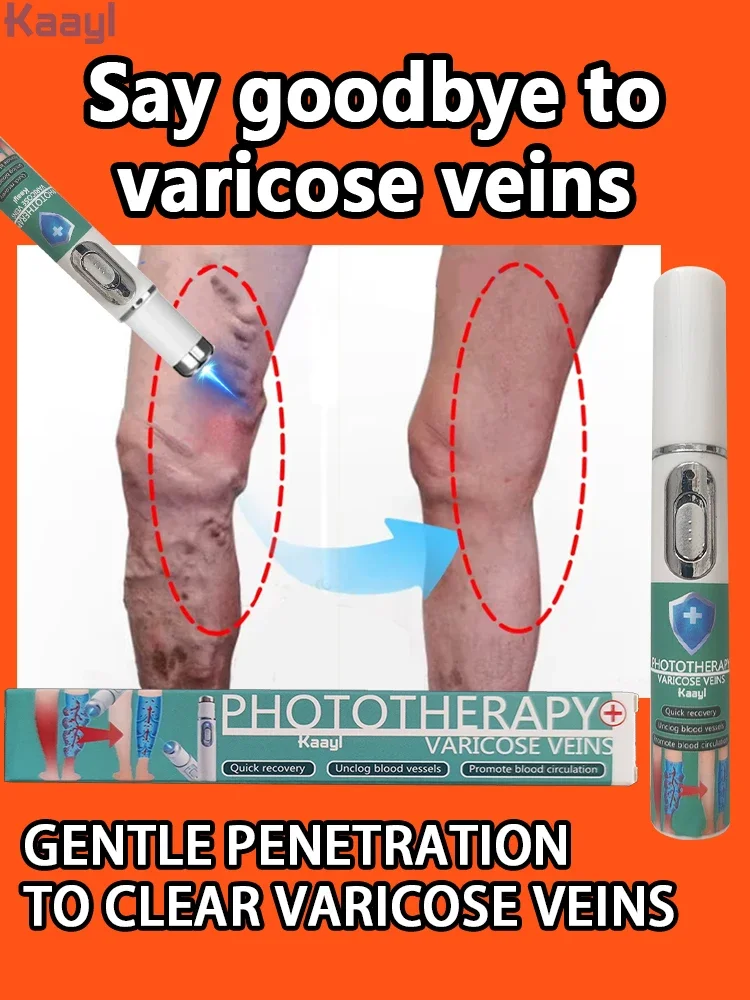 Laser vein | Reduces Spider Veins and Heaviness | for Anyone with Sedentary or Standing
Laser vein | Reduces Spider Veins and Heaviness | for Anyone with Sedentary or Standing