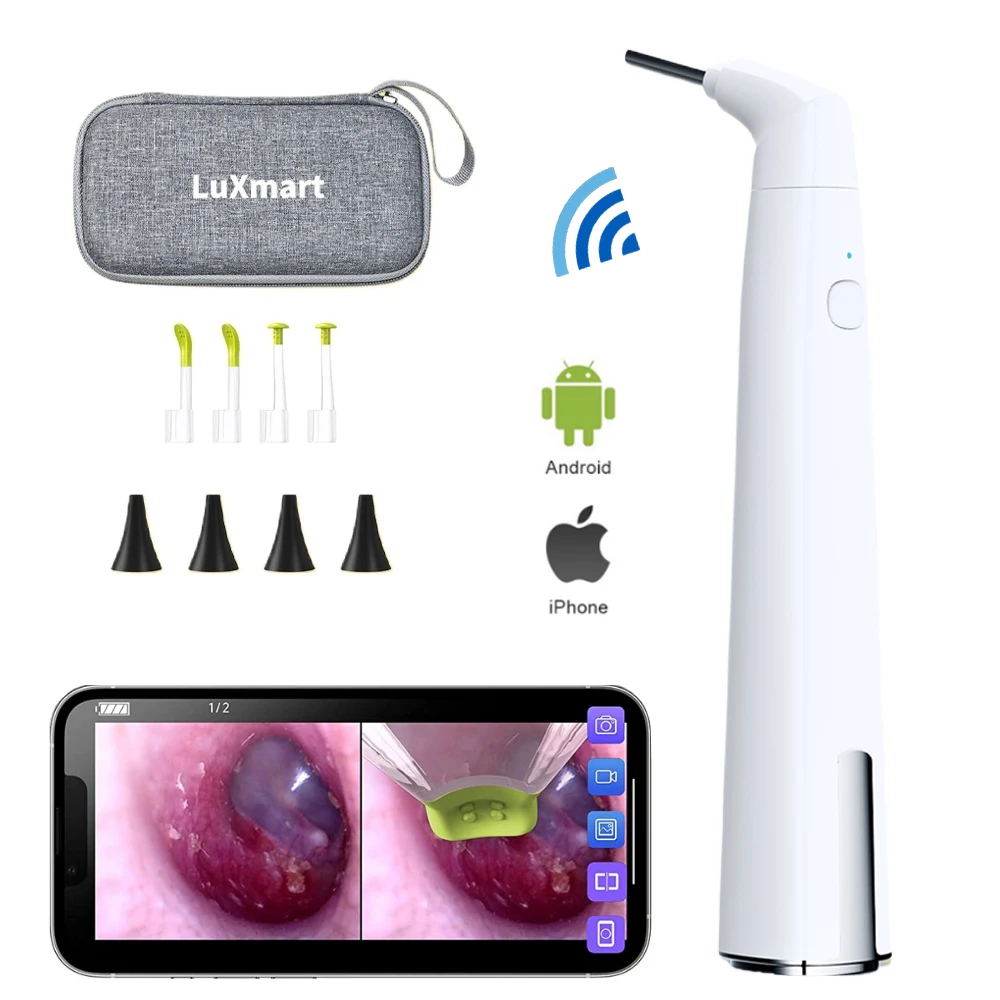 3.9mm Ear Scope Camera with Dual View Wifi Digital Otoscope 720P with 6 LED Lights for Kids and Pets work with IOS Android
3.9mm Ear Scope Camera with Dual View Wifi Digital Otoscope 720P with 6 LED Lights for Kids and Pets work with IOS Android