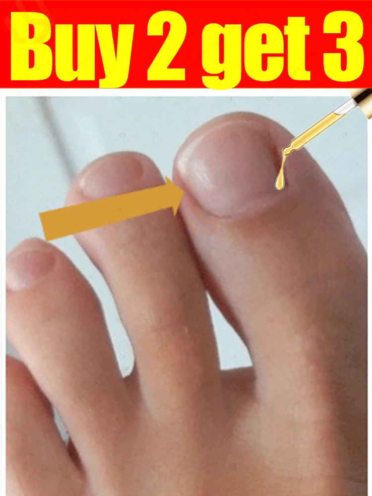 gray manicure painless rehabilitate 
gray manicure painless rehabilitate