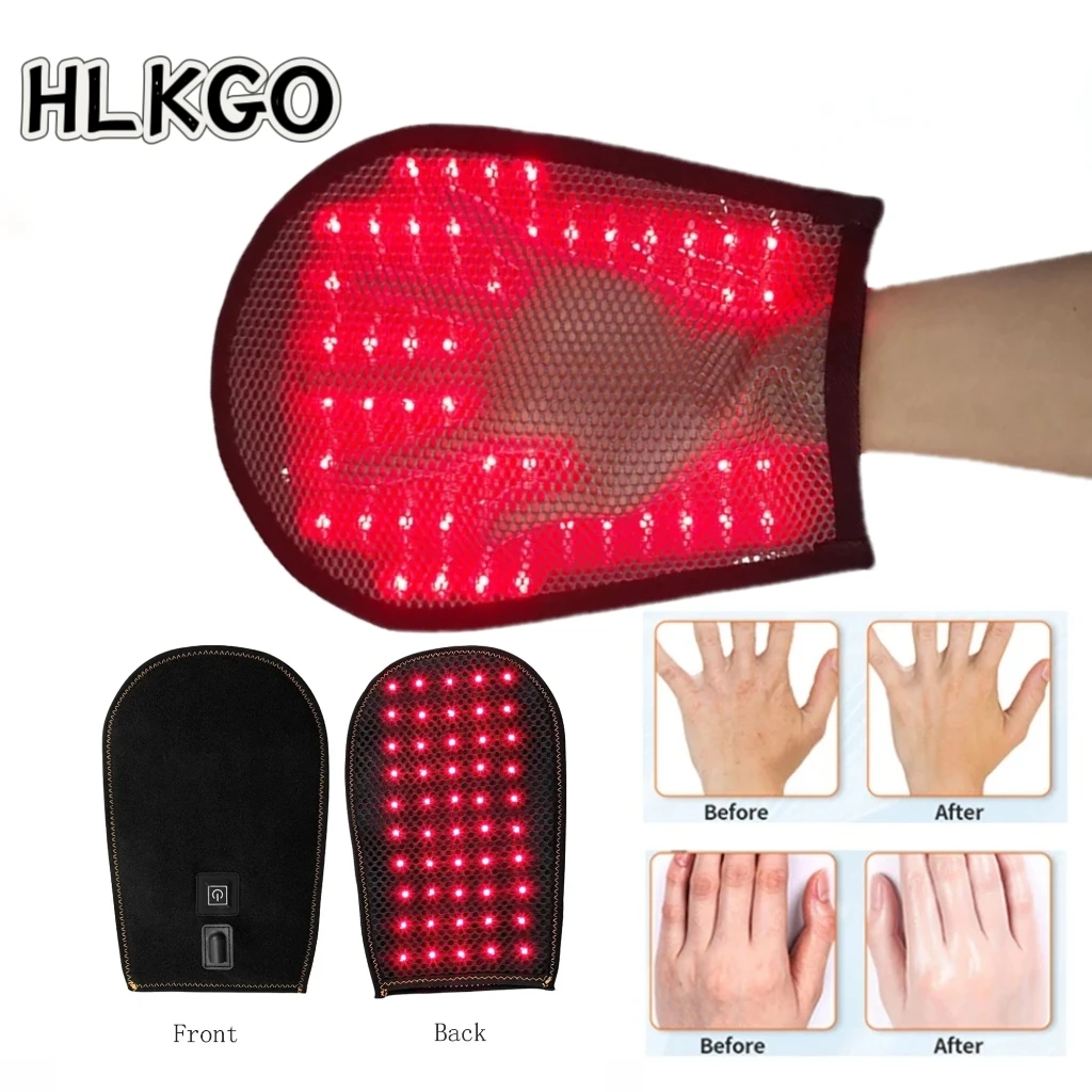 Перчатка для светотерапии с LED-подсветкой (660 нм красный, 850 нм инфракрасный) с двойной длиной волны для облегчения боли в суставах рук и пальцев
Перчатка для светотерапии с LED-подсветкой (660 нм красный, 850 нм инфракрасный) с двойной длиной волны для облегчения боли в суставах рук и пальцев