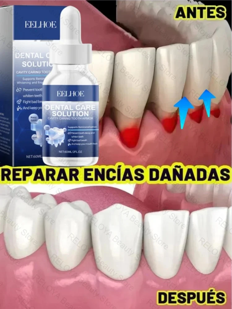 Fast Repair Gums Serum Effectively Relieve Tooth Allergy Dental Caries Tooth Cleaning Toothpaste Repair Tooth Damage Drops Care
Fast Repair Gums Serum Effectively Relieve Tooth Allergy Dental Caries Tooth Cleaning Toothpaste Repair Tooth Damage Drops Care