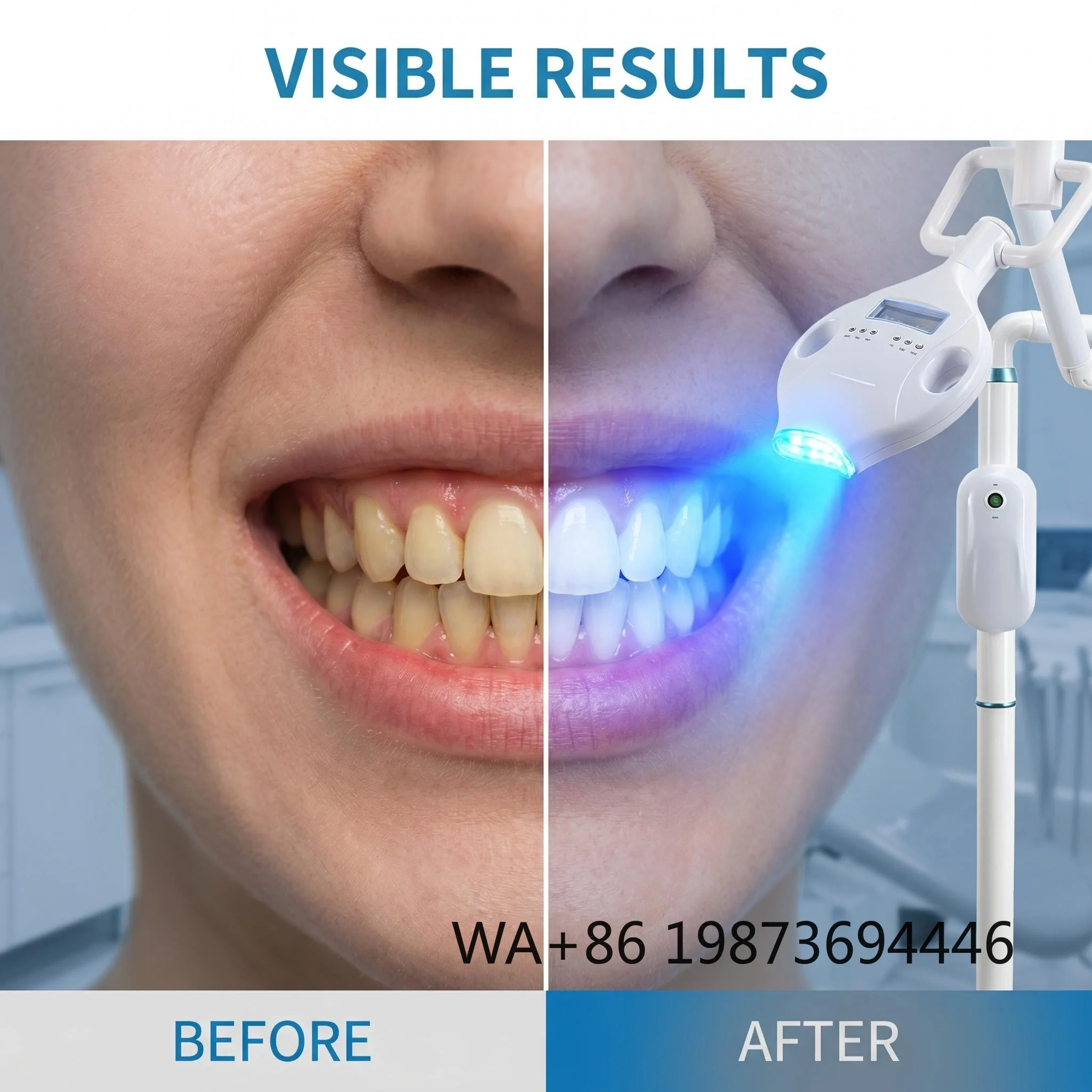 40W Professional LED Teeth Whitening Accelerator Lamp High Power Dental Whitening Device
40W Professional LED Teeth Whitening Accelerator Lamp High Power Dental Whitening Device