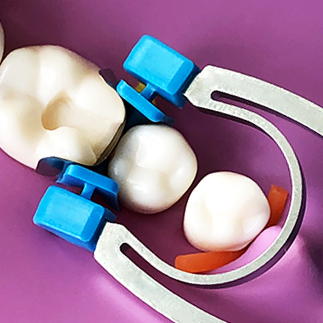 Набор стоматологических секционных матричных систем G2, 30 шт. лент и 1 ручной фиксатор, зажимное кольцо R4, зажим, быстрый класс II, восстановление, стоматология
Набор стоматологических секционных матричных систем G2, 30 шт. лент и 1 ручной фиксатор, зажимное кольцо R4, зажим, быстрый класс II, восстановление, стоматология