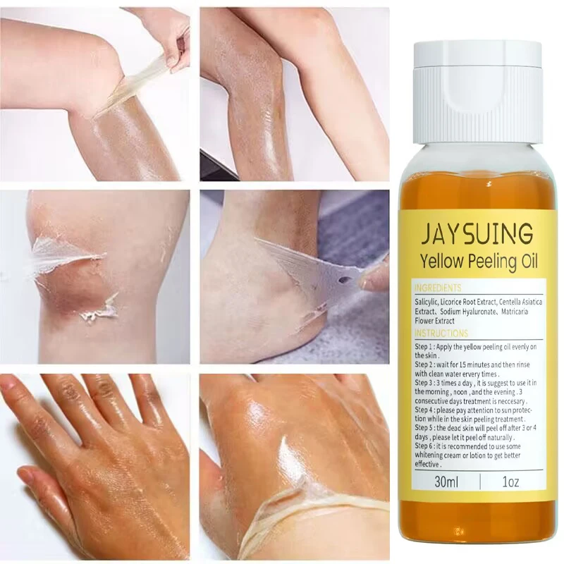 Yellow Peeling Oil Dark Skin Bleaching Remove Arm Knee Legs Melanin Body Exfoliation Brightening Whitening Beauty Skin Care 30ml
Yellow Peeling Oil Dark Skin Bleaching Remove Arm Knee Legs Melanin Body Exfoliation Brightening Whitening Beauty Skin Care 30ml