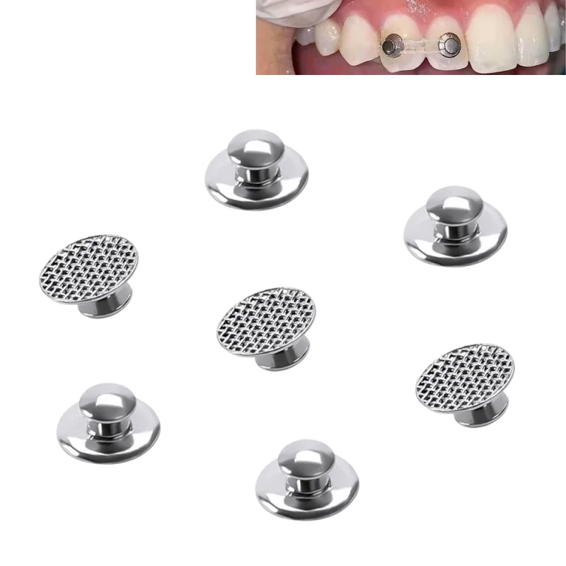 30pcs Dental Lingual Buttons Mesh Base Round Type Bondable for Braces Stainless Steel Orthodontic Material Dentistry Accessories
30pcs Dental Lingual Buttons Mesh Base Round Type Bondable for Braces Stainless Steel Orthodontic Material Dentistry Accessories