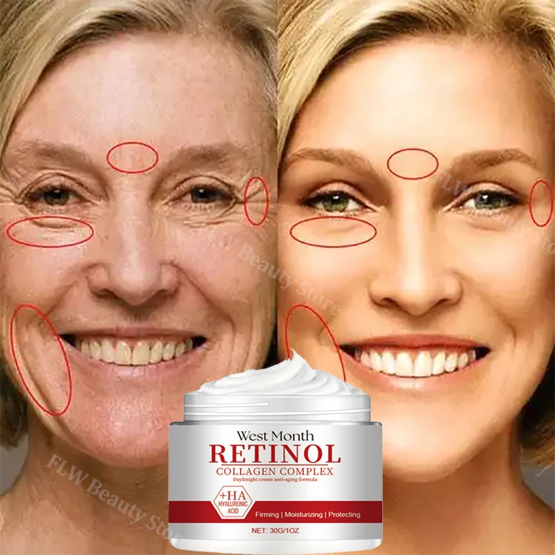 Retinol Anti-Age Face Cream Fast Remove Wrinkle Firming Lifting Anti-Aging Fade Fine Lines Moisturizing Repair Sooth Skin Care
Retinol Anti-Age Face Cream Fast Remove Wrinkle Firming Lifting Anti-Aging Fade Fine Lines Moisturizing Repair Sooth Skin Care