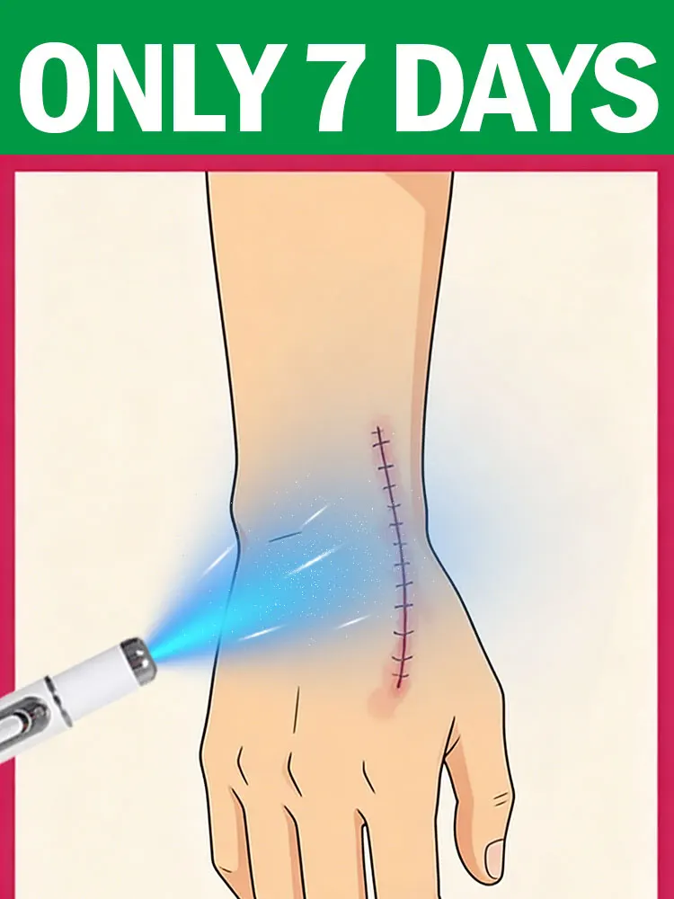 Лазер синего света. Новинка. Без вреда для здоровья.
Лазер синего света. Новинка. Без вреда для здоровья.