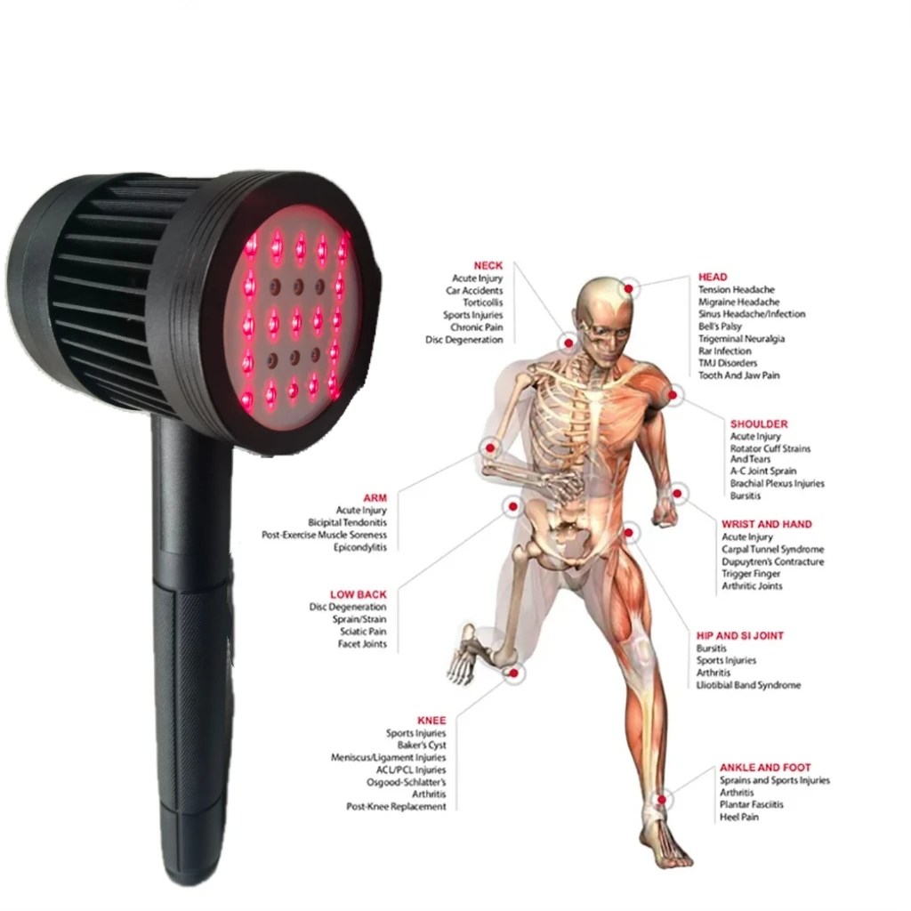Professional 5W Cold Laser Pain Relief Device 650nm+808nm for Neck, Back, Knee, Shoulder Pain - Fast & Effective
Professional 5W Cold Laser Pain Relief Device 650nm+808nm for Neck, Back, Knee, Shoulder Pain - Fast & Effective