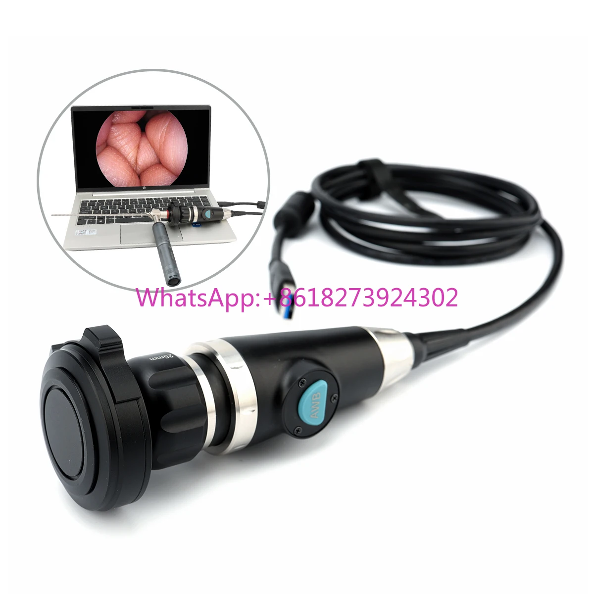 Factory Delivery Portable Endoscope Camera System, USB Endoscope Medical Camera for Laptop PC Rigid Endoscope Camera
Factory Delivery Portable Endoscope Camera System, USB Endoscope Medical Camera for Laptop PC Rigid Endoscope Camera