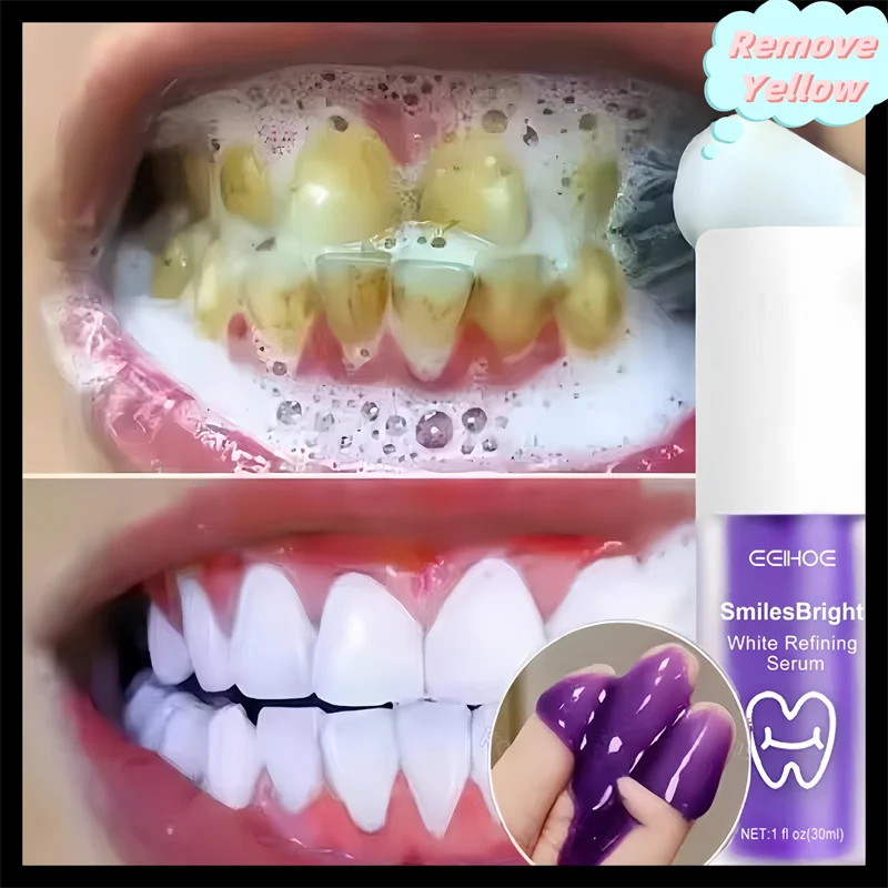 Teeth Cleansing Whitening Toothpaste Whiten Gel Whitener Bleach Removes Stains Fresh Breath Tooth Cleaning Korea Products
Teeth Cleansing Whitening Toothpaste Whiten Gel Whitener Bleach Removes Stains Fresh Breath Tooth Cleaning Korea Products