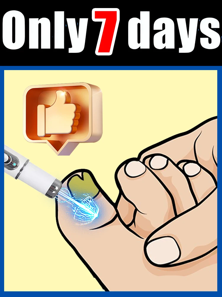 Combo Set 2 Holiday promotions,A best-selling nail laser penʜᴇʟᴘs ʏᴏᴜ sᴀʏ ɢᴏᴏᴅʙʏᴇ ᴛᴏ ᴏɴʏᴄʜᴏᴍʏᴄᴏsɪs.
Combo Set 2 Holiday promotions,A best-selling nail laser penʜᴇʟᴘs ʏᴏᴜ sᴀʏ ɢᴏᴏᴅʙʏᴇ ᴛᴏ ᴏɴʏᴄʜᴏᴍʏᴄᴏsɪs.