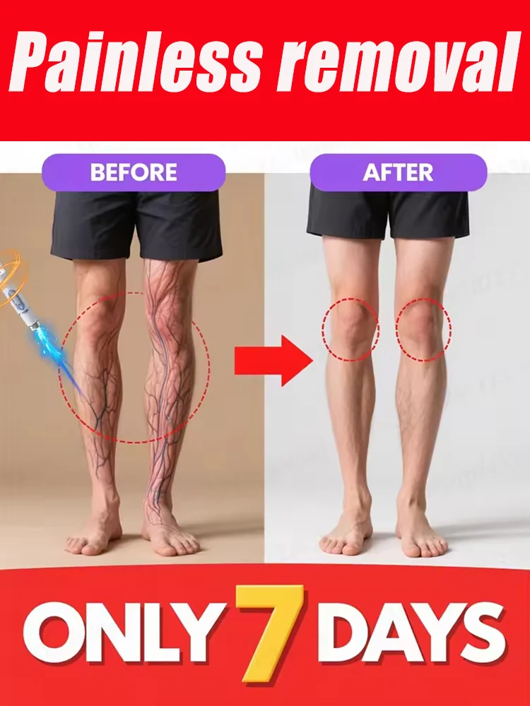 Relax your legs, feet, and arms and deliver quickly.
Relax your legs, feet, and arms and deliver quickly.