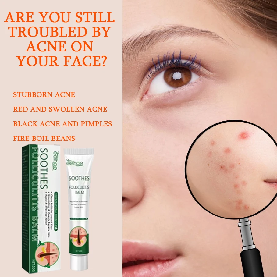 Acne Removing&Anti acne Cream Treatment of Acne Marked Skin Care Whitening&Acne Removing face cream Smooth&Whitening face cream
Acne Removing&Anti acne Cream Treatment of Acne Marked Skin Care Whitening&Acne Removing face cream Smooth&Whitening face cream
