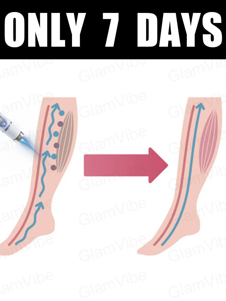 Leg care tools Reduce Uncomfortable For Legs Improving Blood Circulation Varicose Veins Pen Skin Care Product
Leg care tools Reduce Uncomfortable For Legs Improving Blood Circulation Varicose Veins Pen Skin Care Product